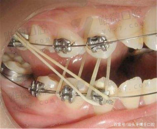口腔颌面医学影像（医学影像科是干嘛的）(图1)